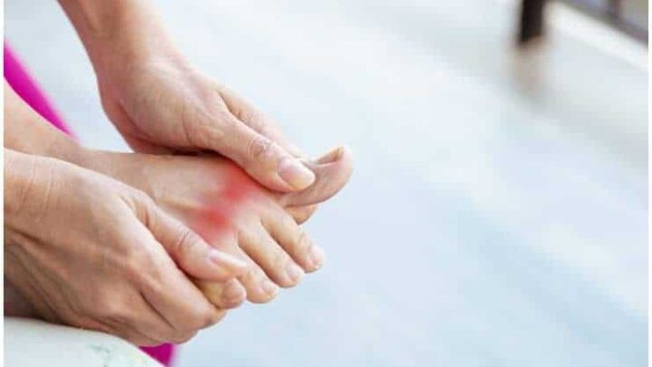 Gout (Gouty Arthritis) - Spiritual Meaning, Causes and Healing