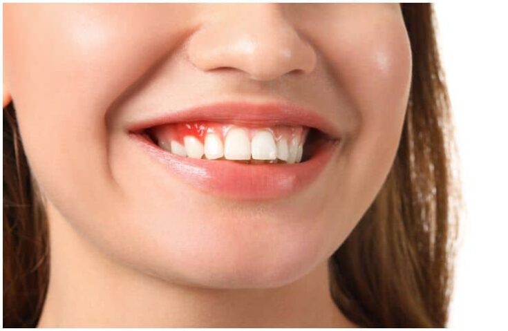 What Is The Spiritual Meaning Behind Teeth Problems Wisdom Teeth 