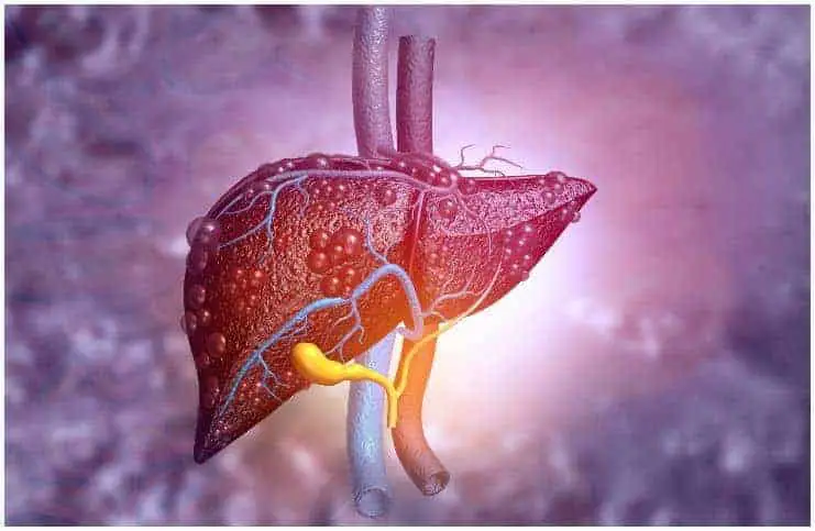 Spiritual Causes of Liver Disease
