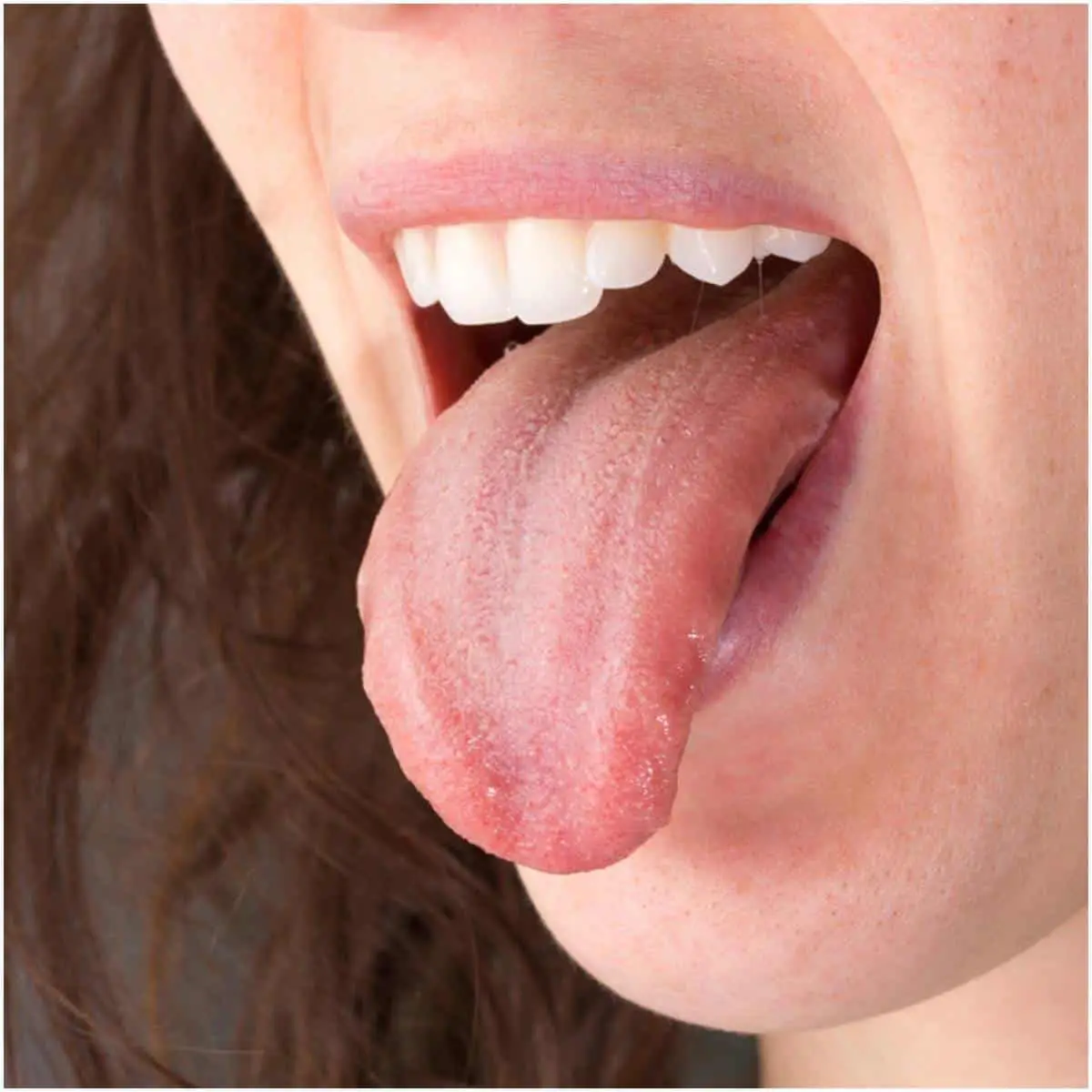 Symptoms of qi deficiency related to the tongue