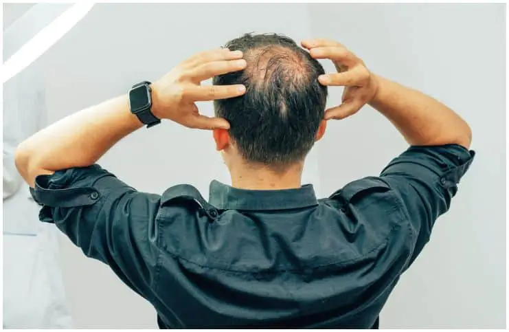 Spiritual Meaning Of Hair Loss