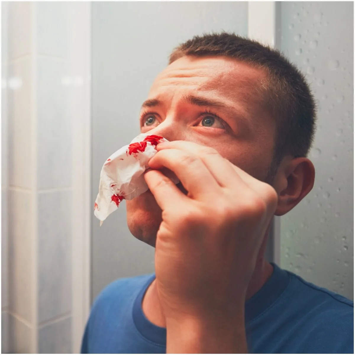 First Aid Management For Nosebleeds