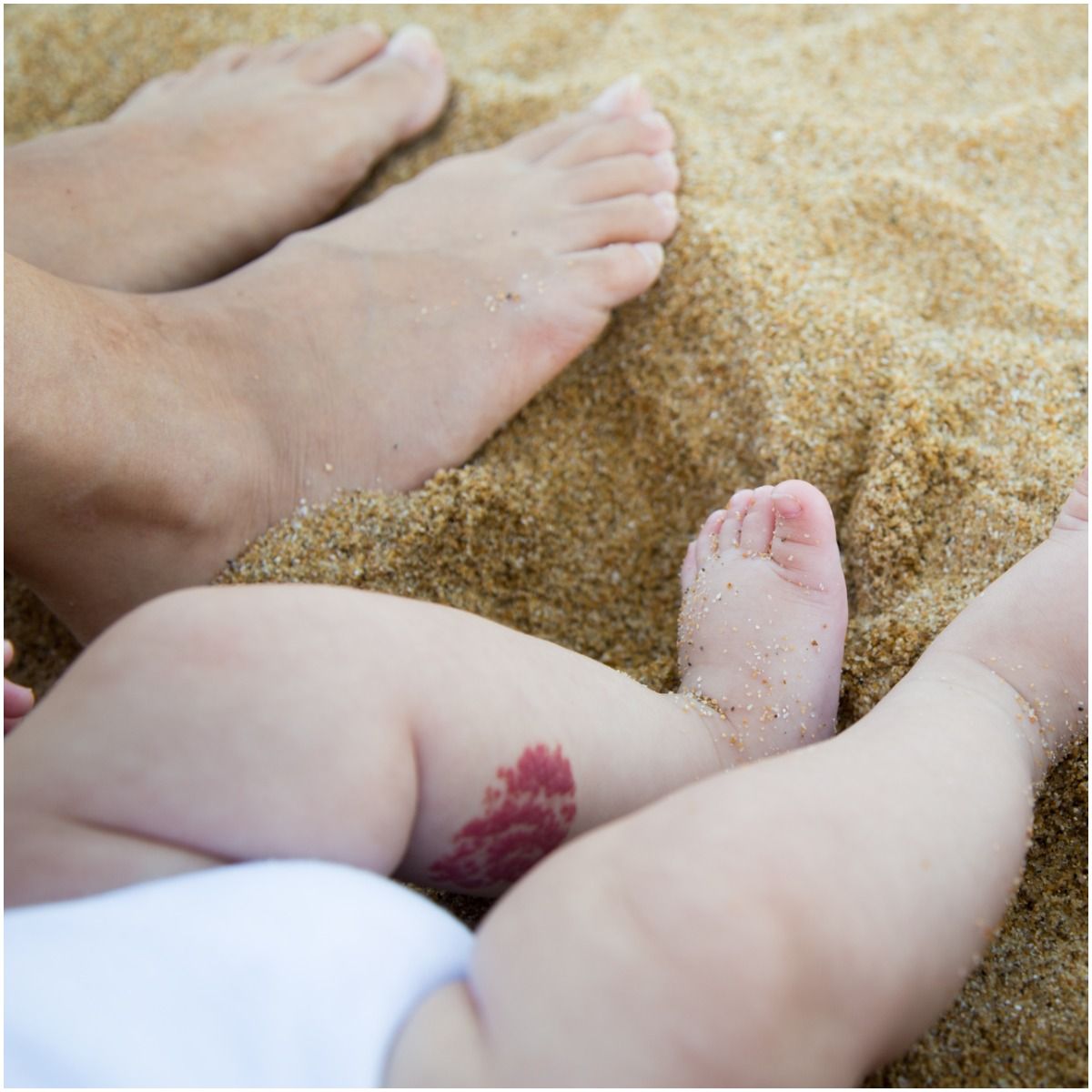 birthmark on baby foot