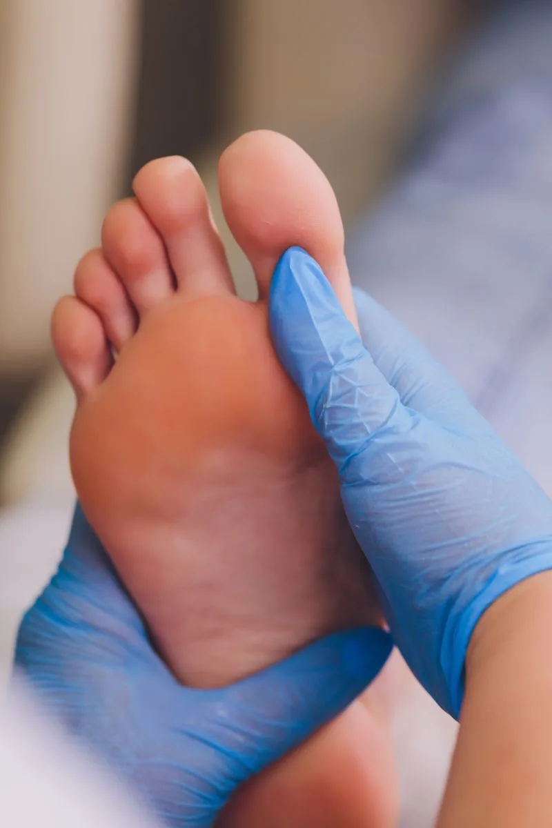 Athlete's Foot (Tinea Pedis) Spiritual Meaning, Causes and Healing