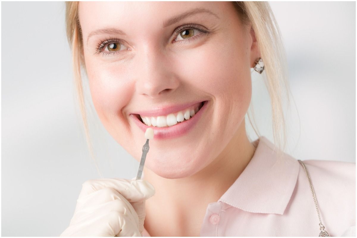 Veneer FAQs - Insight state