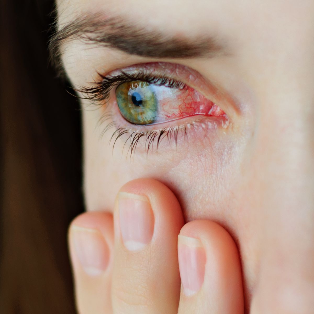 Conjunctivitis (Pinkeye) Spiritual Meaning