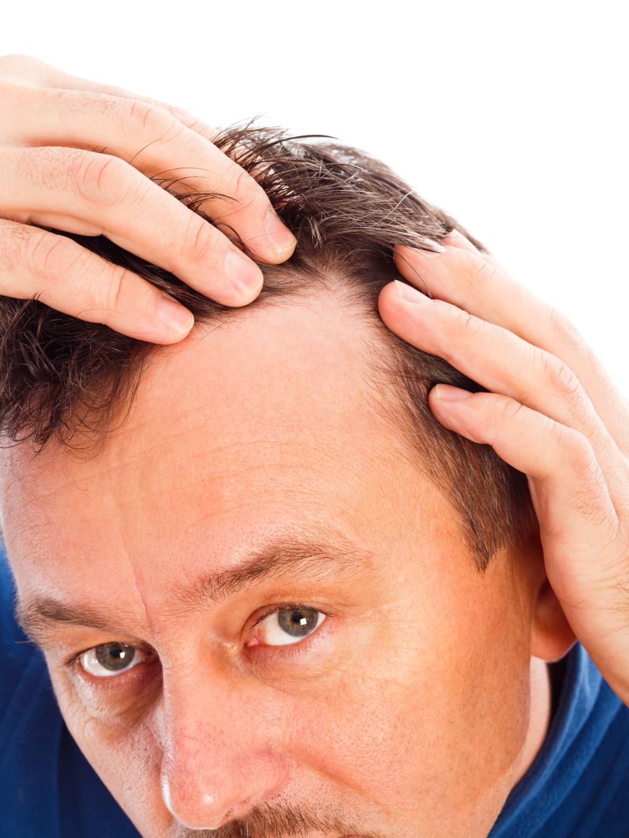 Spiritual Meaning Of Hair Loss In Dreams